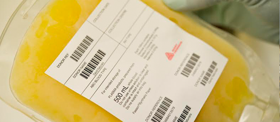 Yellow plasma bag with barcode label illustrating secondary blood bag label performance